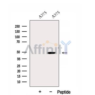DNAJA2 Antibody - Western blot analysis of extracts from A375 cells, using DNAJA2 Antibody.