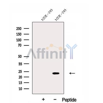 DNAJC12 Antibody - Western blot analysis of extracts from HEK-293 cells, using DNAJC12 Antibody.
