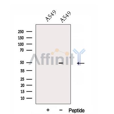 DNASE2B Antibody - Western blot analysis of extracts from A549 cells, using DNASE2B Antibody.