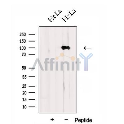 DNM2 Antibody - Western blot analysis of extracts from HeLa cells, using DNM2 Antibody.
