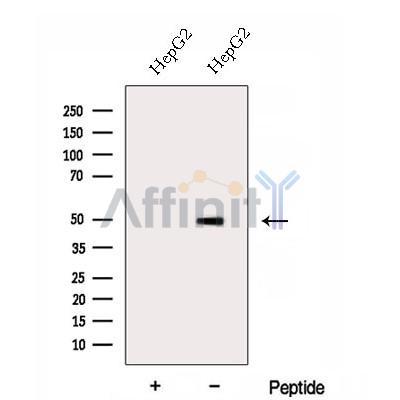 DOC2B Antibody - Western blot analysis of extracts from HepG2 cells, using DOC2B Antibody.