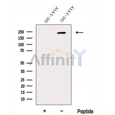 DOCK3;MOCA Antibody - Western blot analysis of extracts from SH-SY5Y cells, using DOCK3;MOCA Antibody.