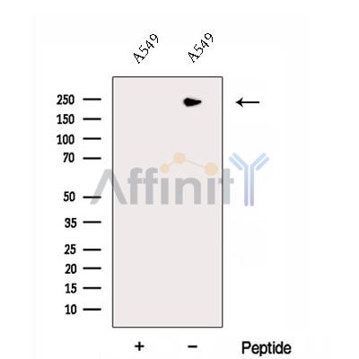 DOCK8 Antibody - Western blot analysis of extracts from A549 cells, using DOCK8 Antibody.