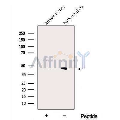DPEP2 Antibody - Western blot analysis of extracts from Human kidney tissue, using DPEP2 Antibody.