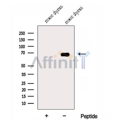 DPP3 Antibody - Western blot analysis of extracts from Mouse thymus tissue, using DPP3 Antibody.
