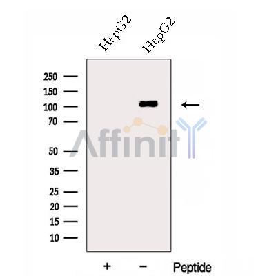 DSE Antibody - Western blot analysis of extracts from HepG2 cells, using DSE Antibody.