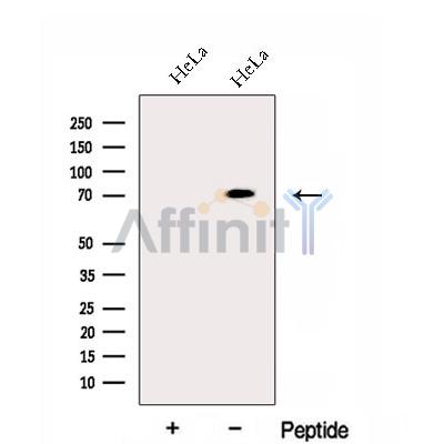 ECD Antibody - Western blot analysis of extracts from HeLa cells, using ECD Antibody.