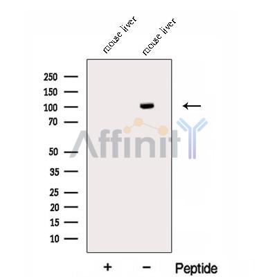 ECE2 Antibody - Western blot analysis of extracts from Mouse liver tissue , using ECE2 Antibody.
