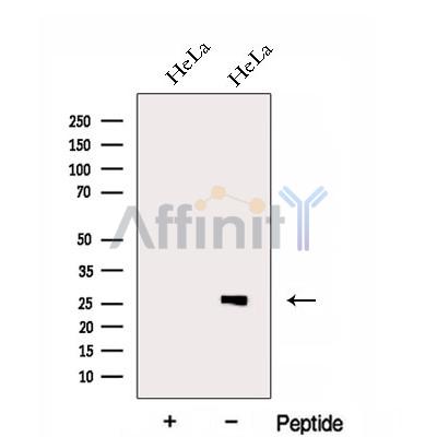 EIF4H Antibody - Western blot analysis of extracts from HeLa cells, using EIF4H Antibody.