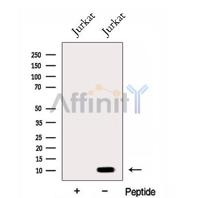 ENY2 Antibody - Western blot analysis of extracts from Jurkat cells, using ENY2 Antibody.