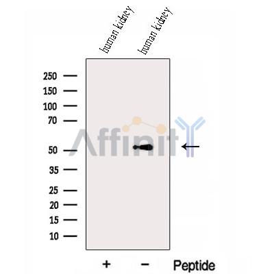 ESRRG Antibody - Western blot analysis of extracts from Human kidney tissue, using ESRRG Antibody.
