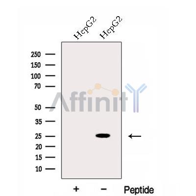 EVI2A Antibody - Western blot analysis of extracts from HepG2 cells, using EVI2A Antibody.