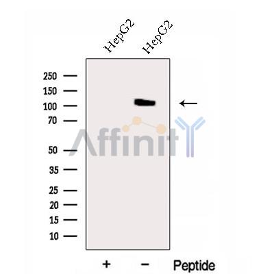 EXOC6 Antibody - Western blot analysis of extracts from HepG2 cells, using EXOC6 Antibody.