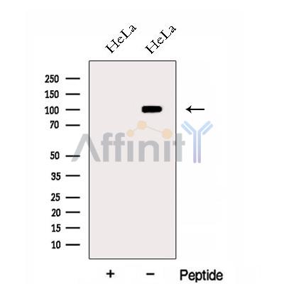 EXOSC10 Antibody - Western blot analysis of extracts from HeLa cells, using EXOSC10 Antibody.
