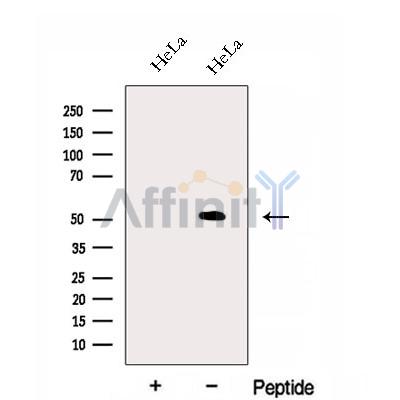 FAM124B Antibody - Western blot analysis of extracts from HeLa cells, using FAM124B Antibody.