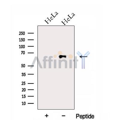 FAM13A Antibody - Western blot analysis of extracts from HeLa cells, using FAM13A Antibody.