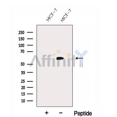 FBXO7 Antibody - Western blot analysis of extracts from MCF-7 cells, using FBXO7 Antibody.