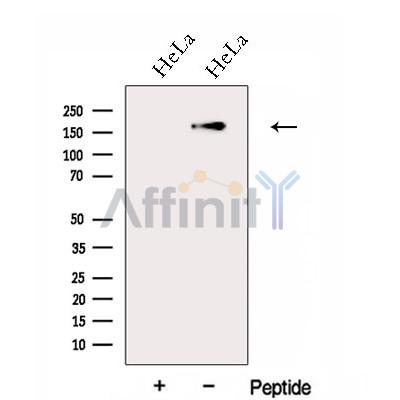 FGD5 Antibody - Western blot analysis of extracts from HeLa cells, using FGD5 Antibody.