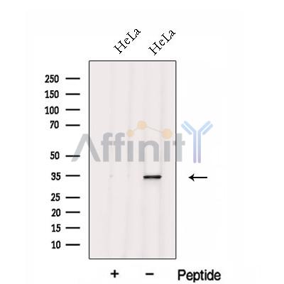 FGL1 Antibody - Western blot analysis of extracts from HeLa cells, using FGL1 Antibody.