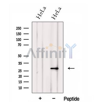 FKBP14 Antibody - Western blot analysis of extracts from HeLa cells, using FKBP14 Antibody.