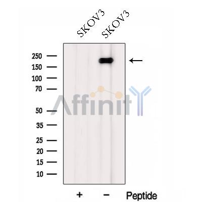 FMN2 Antibody - Western blot analysis of extracts from SKOV3 cells, using FMN2 Antibody.
