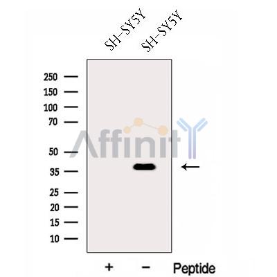 FOXR2 Antibody - Western blot analysis of extracts from SH-SY5Y cells, using FOXR2 Antibody.