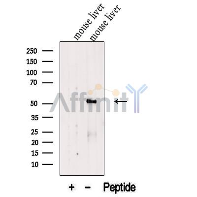 FTCD Antibody - Western blot analysis of extracts from Mouse liver tissue , using 58K Golgi protein Antibody.