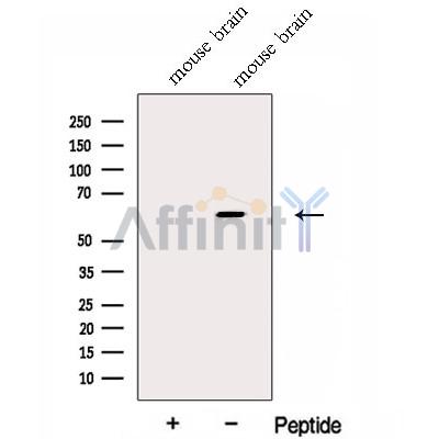 Fukutin Antibody - Western blot analysis of extracts from Mouse brain tissue , using Fukutin Antibody.