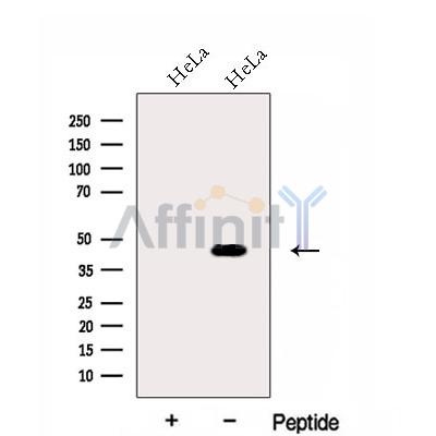 FUT6 Antibody - Western blot analysis of extracts from HeLa cells, using FUT6 Antibody.