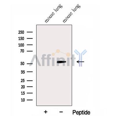 GABPB1 Antibody - Western blot analysis of extracts from Mouse lung tissue, using GABPB1 Antibody.