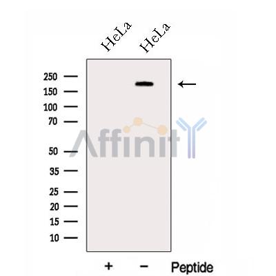 GBF1 Antibody - Western blot analysis of extracts from HeLa cells, using GBF1 Antibody.