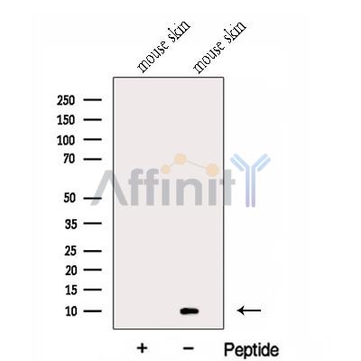 GCHFR Antibody - Western blot analysis of extracts from Mouse skin tissue, using GCHFR Antibody.