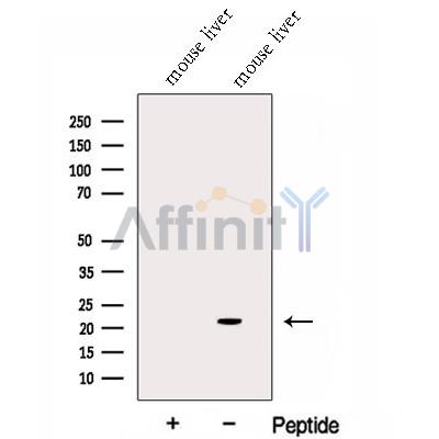 GGCT Antibody - Western blot analysis of extracts from Mouse liver tissue , using GGCT Antibody.