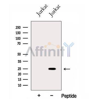 GINS3 Antibody - Western blot analysis of extracts from Jurkat cells, using GINS3 Antibody.