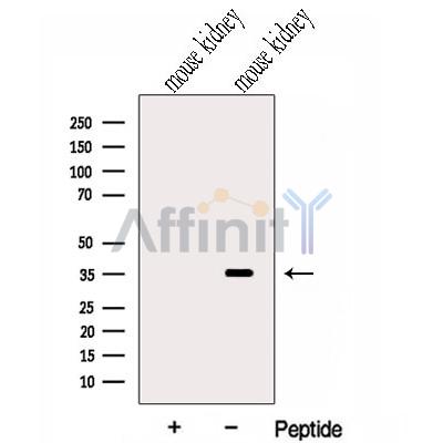 GLOD4 Antibody - Western blot analysis of extracts from Mouse kidney tissue, using GLOD4 Antibody.