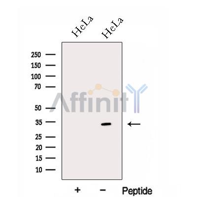 GNPDA1 Antibody - Western blot analysis of extracts from HeLa cells, using GNPDA1 Antibody.