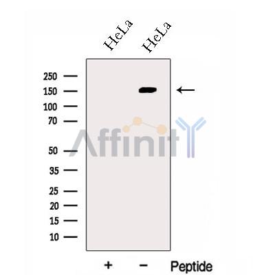 GOLGA3 Antibody - Western blot analysis of extracts from HeLa cells, using GOLGA3 Antibody.