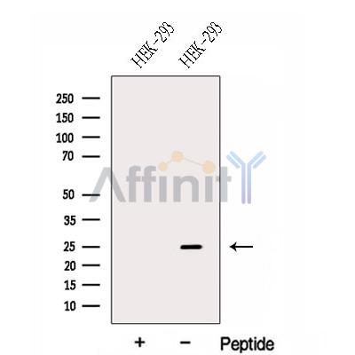GPX8 Antibody - Western blot analysis of extracts from HEK-293 cells , using GPX8 Antibody.