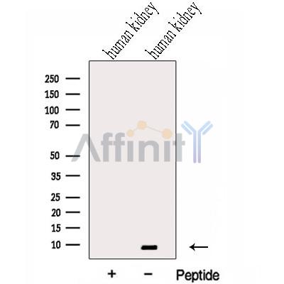 GTF2H5 Antibody - Western blot analysis of extracts from Human kidney tissue, using GTF2H5 Antibody.