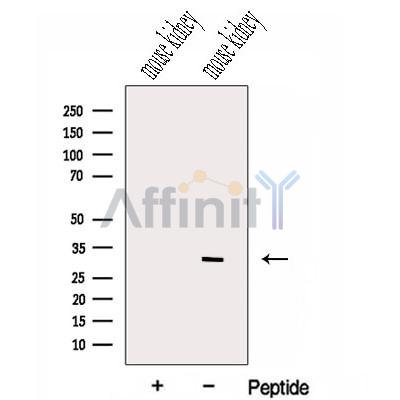 HIST1H1T Antibody - Western blot analysis of extracts from Mouse kidney tissue, using HIST1H1T Antibody.