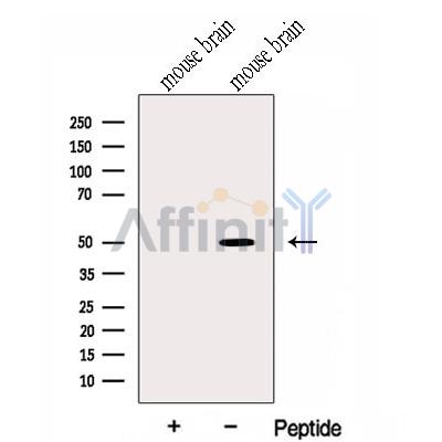 HMBOX1 Antibody - Western blot analysis of extracts from Mouse brain tissue , using HMBOX1 Antibody.