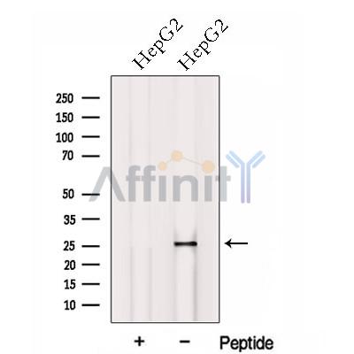 HOXB7 Antibody - Western blot analysis of extracts from HepG2 cells, using HOXB7 Antibody.