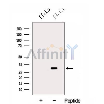 HOXC4 Antibody - Western blot analysis of extracts from HeLa cells, using HOXC4 Antibody.