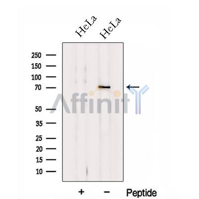 HP1BP3 Antibody - Western blot analysis of extracts from HeLa cells, using HP1BP3 Antibody.