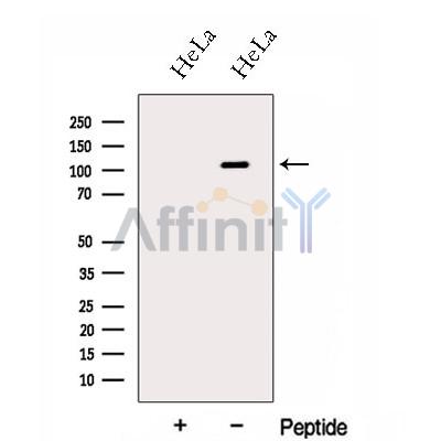 HPS3 Antibody - Western blot analysis of extracts from HeLa cells, using HPS3 Antibody.