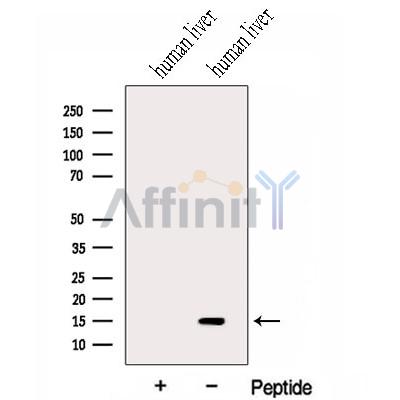 HRSP12 Antibody - Western blot analysis of extracts from Human liver tissue, using HRSP12 Antibody.