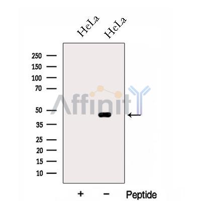 HSDL2 Antibody - Western blot analysis of extracts from HeLa cells, using HSDL2 Antibody.