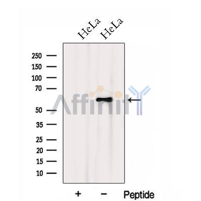 HSPA13 Antibody - Western blot analysis of extracts from HeLa cells, using HSPA13 Antibody.
