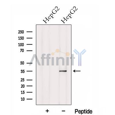 HTRA1 Antibody - Western blot analysis of extracts from HepG2 cells, using HTRA1 Antibody.