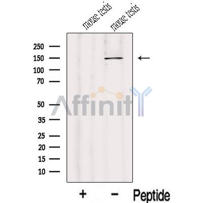 IFT122 Antibody - Western blot analysis of extracts from Mouse testis tissue, using IFT122 Antibody.